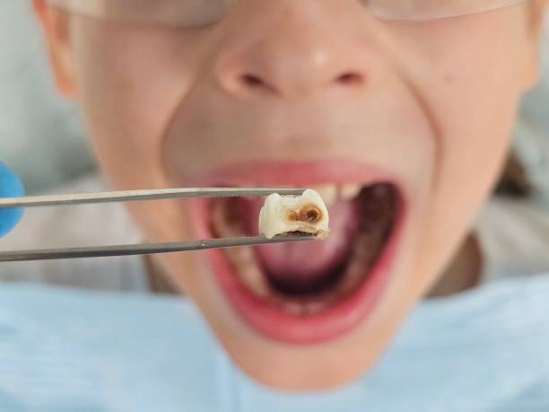 Best Broken or Cracked Tooth Emergency Dentist in Toftrees, PA