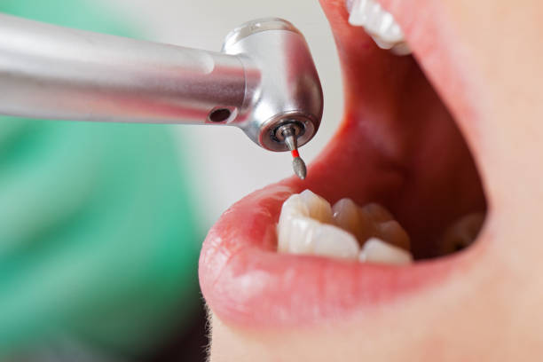 Best Emergency Dentist for Special Needs Patients in Toftrees, PA